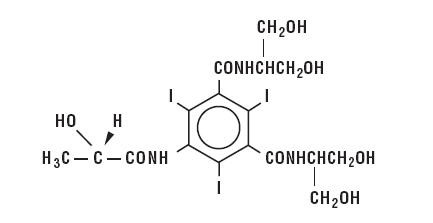 Isovue